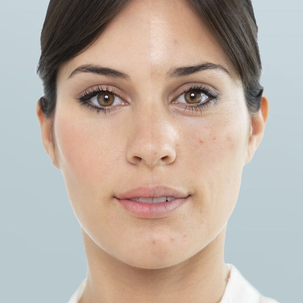 Facial Steamer by InnovaG – Deep Hydration & Detox at Home